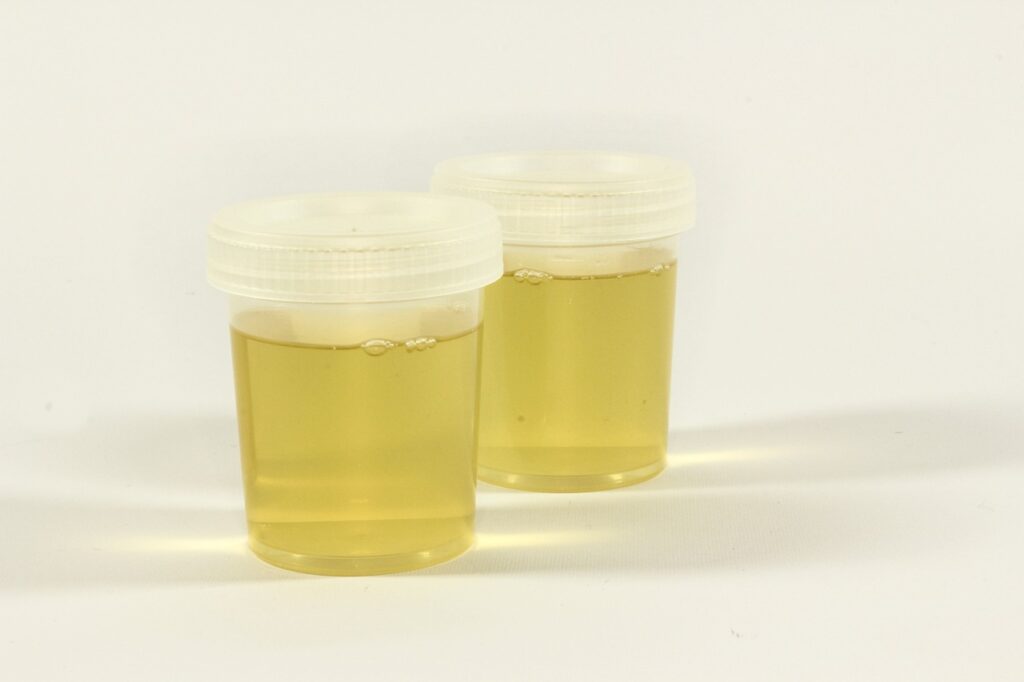 test, a container for urine, urine, inflammation, analysis, medical, lab, test tube, diagnostics, tests, the doctor, hospital, medic, download, urine, urine, urine, urine, urine