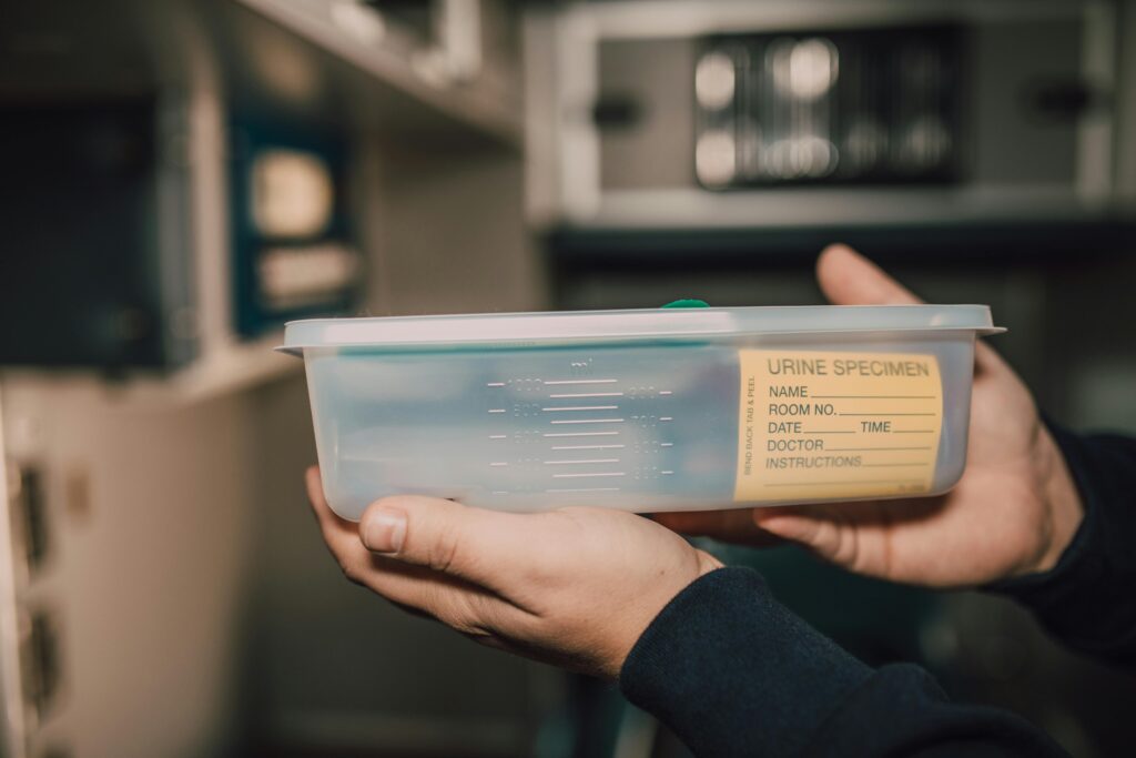 Close-up of hands holding a urine specimen container in a lab environment.