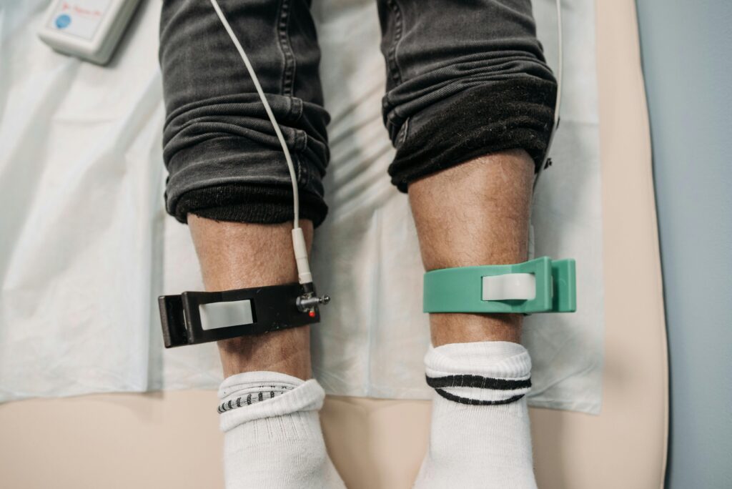 Close-up view of medical electrodes on a patient's lower legs during a medical procedure in a clinic.